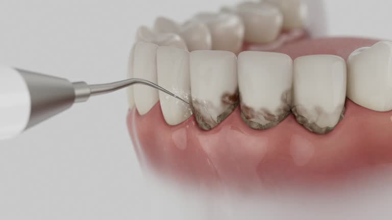 Reliable Dental contractor in Muscoy, CA by Dentist Open Now